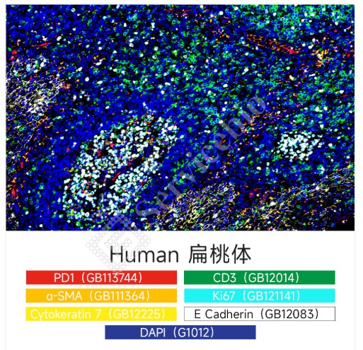 Набор для многоцветного флуоресцентного окрашивания с 6 метками и 7 цветами TSAPLus, Servicebio, Китай