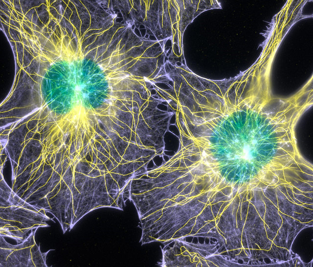 Luminescence fluorescence microscopy: snapshot