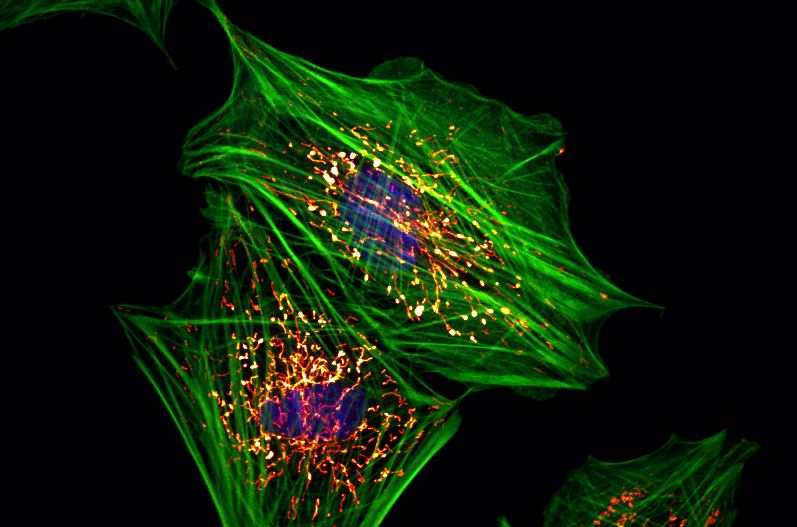 Fluorescence microscopy: image of the object