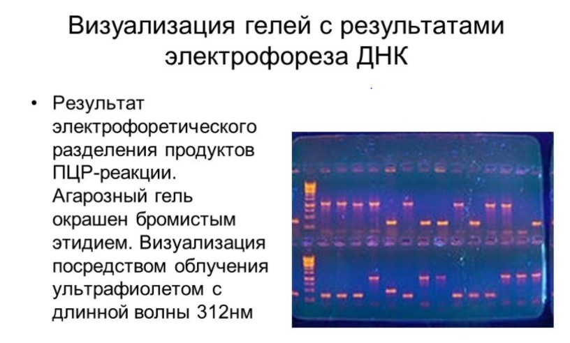 Visualization of gels with DNA electrophoresis results