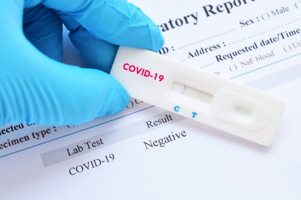 testing for coronovirus testing for coronovirus