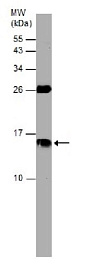 Вестерн-блот анализ плазмы крови человека  Антитела Anti-Cystatin C antibody (ab226841) в разведении 1: 1000 + 30 мкг плазмы крови; Прогнозируемый размер белка: 16 кДа; Гель: 15% полиакриламидный гель с ДСН.