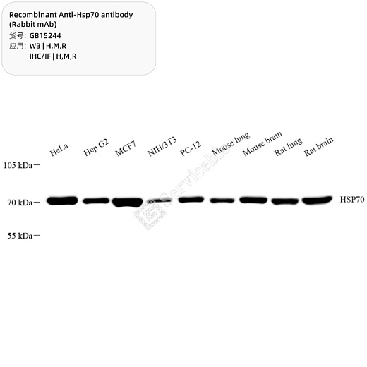 Антитела Anti-Hsp70 Rabbit pAb, кроличьи, рекомбинантные, Servicebio