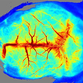 Система визуализации лазерная RFLSI ZW, RWD Life Science, Китай