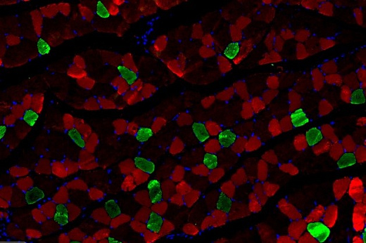 Флуоресцентный набор для двойного окрашивания (IF488+ Red IF555) TSAPLus, Servicebio, Китай