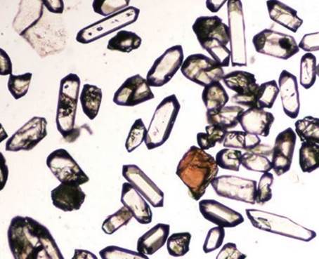 Рис. 3. Фотография кристаллов циркона в проходящем свете без анализатора (поляризационная микроскопия). Фотография кристаллов циркона в проходящем свете без анализатора (поляризационная микроскопия).